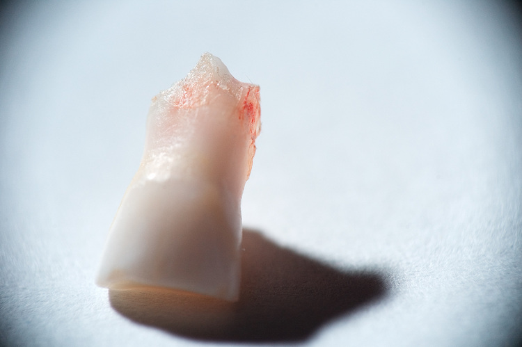 Closeup of a baby tooth